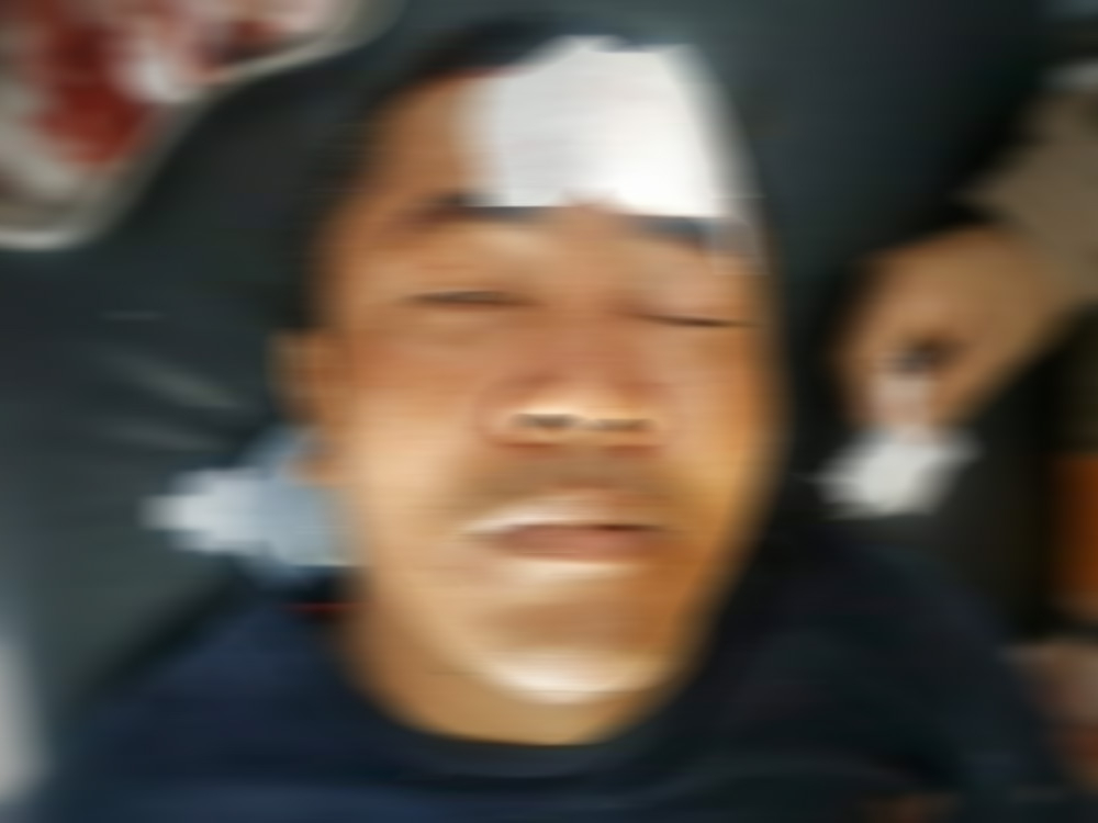 Korban bentrok di Kerinci tertembak senapan angin di kening.